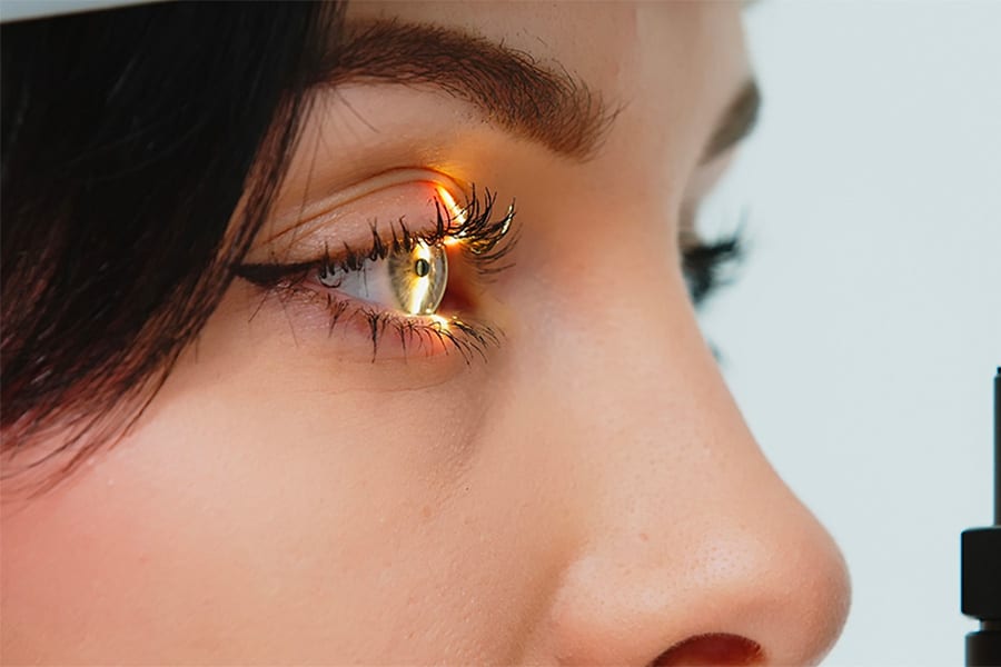 laser yag pour cataracte secondaire chirurgien ophtalmologue specialiste cataracte centre ophtalmologiste ophtalmologie paris est