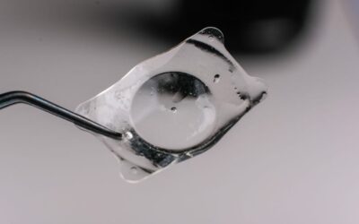 Quels sont les symptômes d’un déplacement d’implant cataracte ?