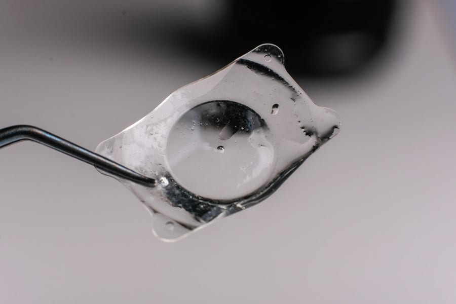 symptome deplacement implant cataracte operation chirurgien ophtalmologue specialiste cataracte centre ophtalmologiste ophtalmologie paris est