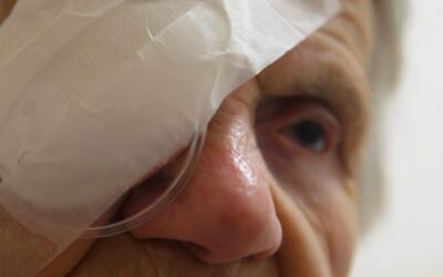 Combien de temps garder la coque après l’opération de cataracte ?