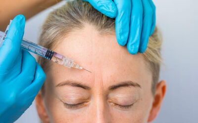 Botox pour la ride du lion : combien de temps ça dure ?