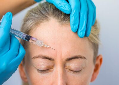 Botox pour la ride du lion : combien de temps ça dure ?