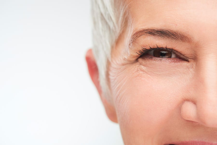 injection ride pattes d oie traitement botox medecine ophtalmologie esthetique chirurgiens ophtalmologues paris centre ophtalmologique ophtalmologie paris est